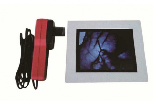 Vein Viewer Machine