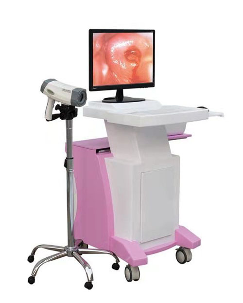 Digital Trolley Colposcope