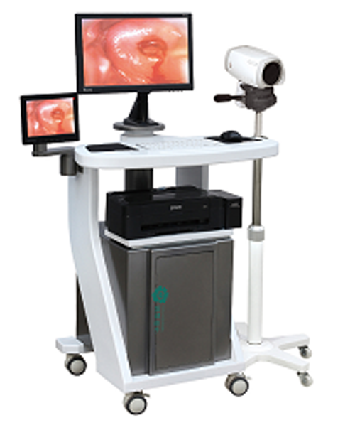 Portable Digital electronic colposcope with double screen