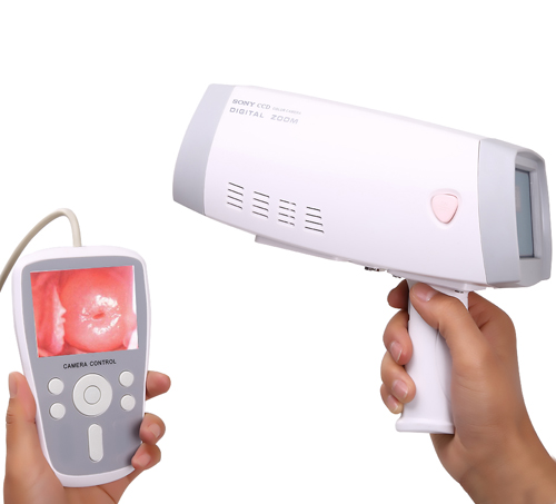 Handheld Video Colposcope           