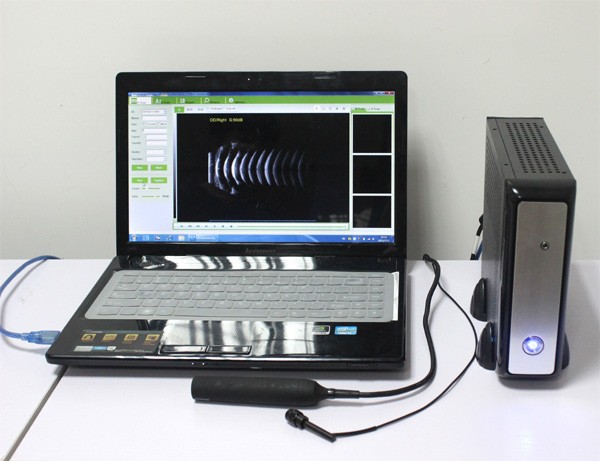 Ophthalmic ultrasound A/B Scanner