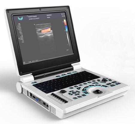 Système de diagnostic par ultrasons Doppler couleur