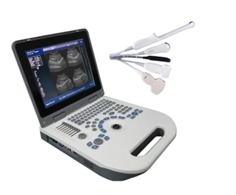 Full Digital LED Portable Ultrasound