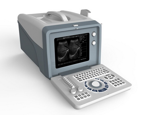 Cost efficient Black Ultrasound machine