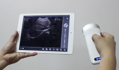 Wireless Ultrasound Convex Linear Microconvex Transvaginal Probe