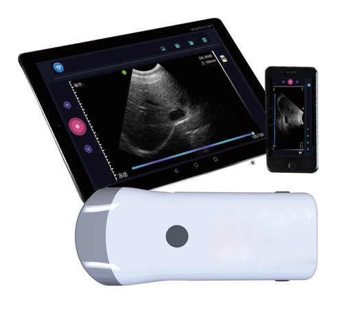 [CCVE6] Wireless B-ultrasound detector electronic probe