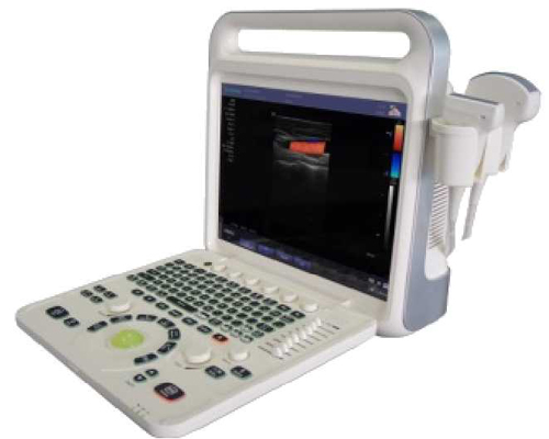 [CCIE60] 15 inch Screen Portable Color Doppler
 With 3D Optional