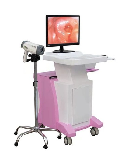 [CCC80C] Digital Trolley Colposcope