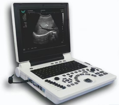 [CCB-P20] Notebook Ultrasound Scanner(3D software Optional)