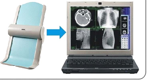 [CCL-880] Medical Film Scanner