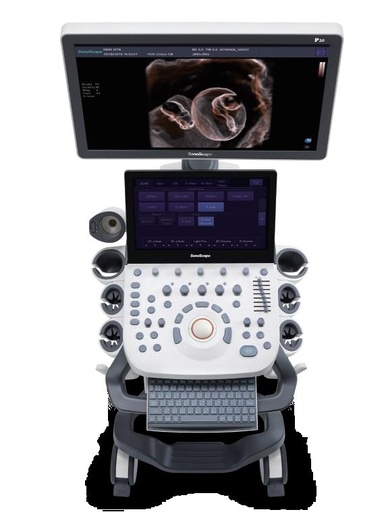 [CCBP20] Máquina de ultrasonido Doppler Color Trolley