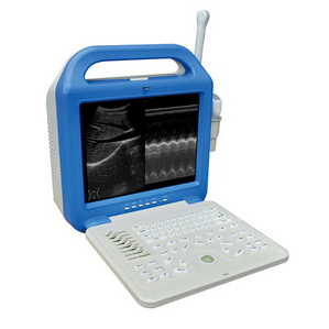 [CCB-51353A-LCD] LCD Screen Digital Laptop Ultrasound Scanner